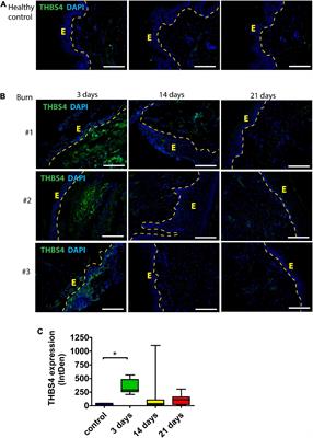 Thrombospondin-4 Is a Soluble Dermal Inflammatory Signal That Selectively Promotes Fibroblast Migration and Keratinocyte Proliferation for Skin Regeneration and Wound Healing